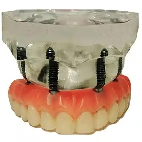 Mostruário antes-1