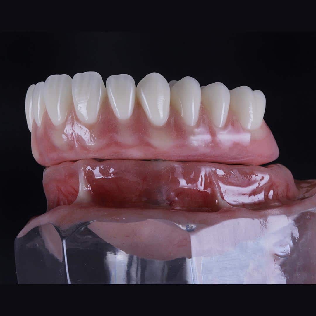 FOTO-6
